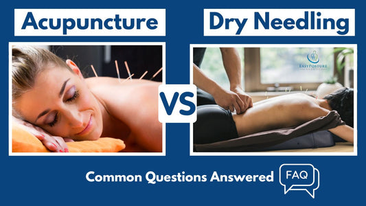 Acupuncture vs Dry Needling - Top 10 Questions Answered