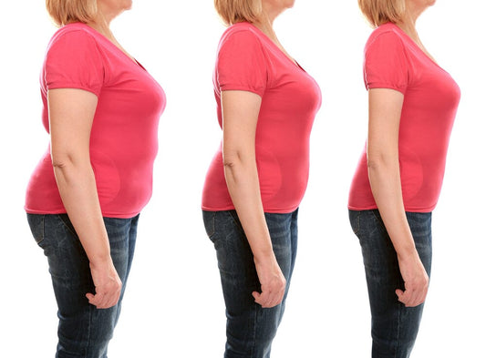 Will Losing Weight Help Sciatica?