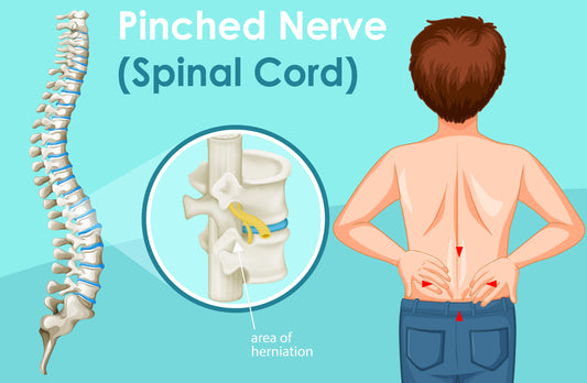 8 Common Symptoms of a Pinched Nerve (and How It Feels)