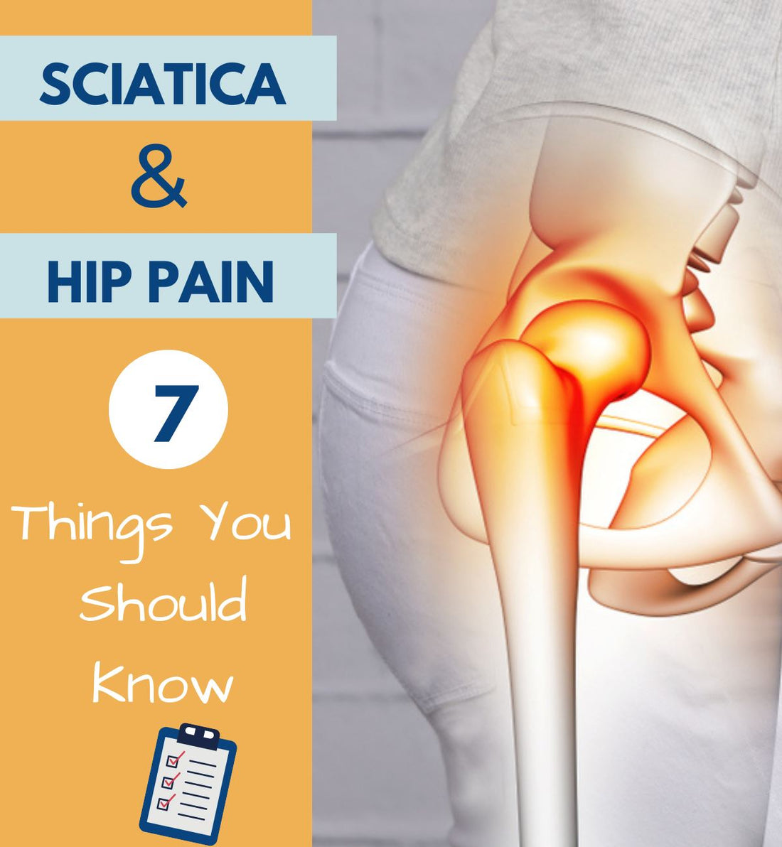 Can Sciatica Cause Hip Pain? 7 Things You to Know