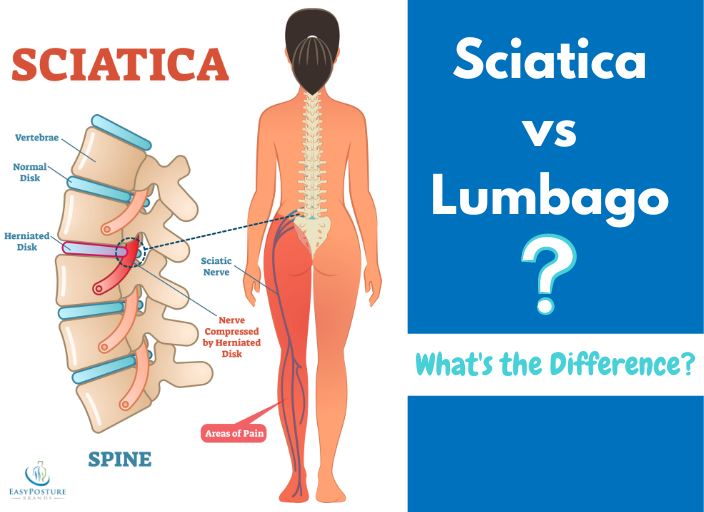 Sciatica with Lumbago: What's the Difference between Sciatica vs Lumbago